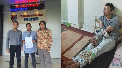 Andi Korban Penganiayaan di Muara Enim Minta Keadilan ke Kapolda Sumsel